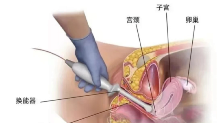 新西兰：中方实弹演习符合国际法,澳门手机看码最快开奖结果功能,决策资料解释落实_极速版V4.57